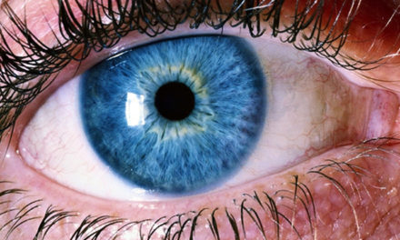 Retinal Detachment: Are You at Risk?