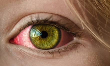 Prevent Pink Eye – Students