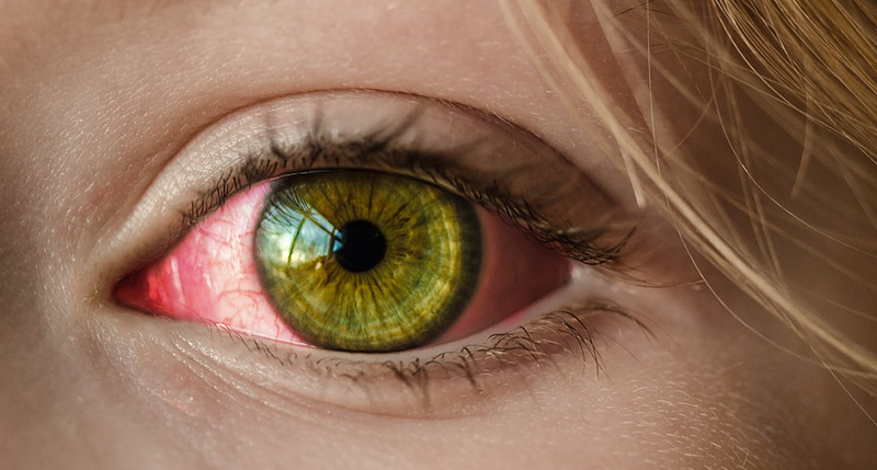 Prevent Pink Eye – Students