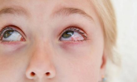 Help Your Student Avoid Pink Eye This School Year