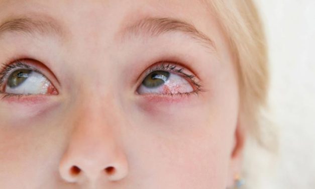 Help Your Student Avoid Pink Eye This School Year