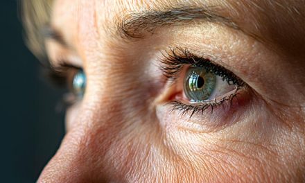 AMD Explained: Who’s at Risk and How It Affects Vision