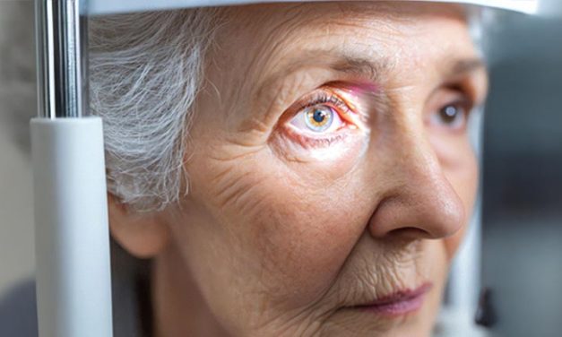 5 Facts to Know About Glaucoma